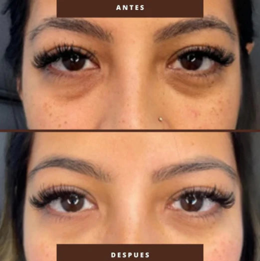MEN EXPERT 🫩 ANTIOJERAS | Tu mirada volverá a reflejar energía, juventud y confianza 💆‍♀️