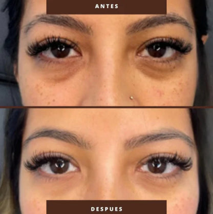 MEN EXPERT 🫩 ANTIOJERAS | Tu mirada volverá a reflejar energía, juventud y confianza 💆‍♀️