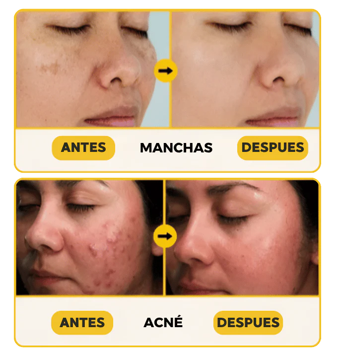 Saphirus 💎 | Restaura tu piel con ingredientes naturales 🌿