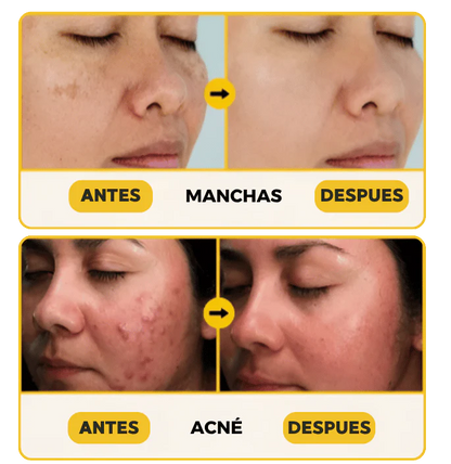 Saphirus 💎 | Restaura tu piel con ingredientes naturales 🌿